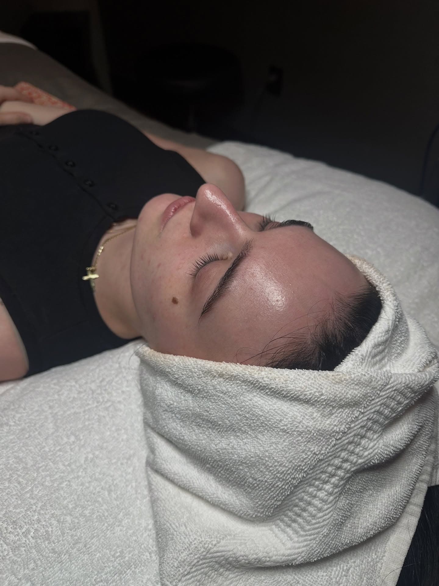 Post-facial skin glow after treatment